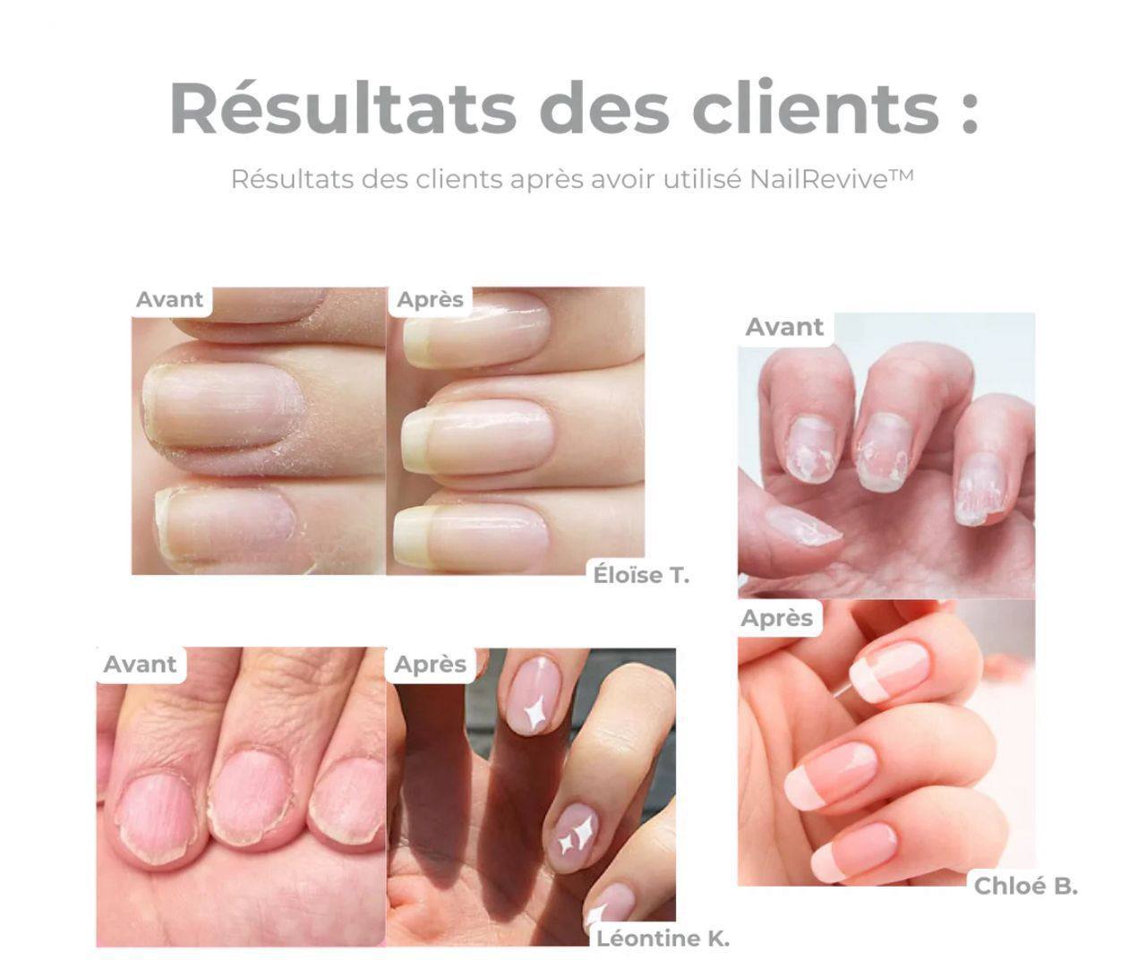 Huile ongles solide ( 1 acheté = 1 offert )